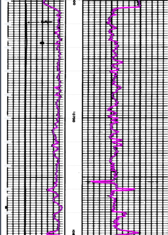 Clean digitized well log